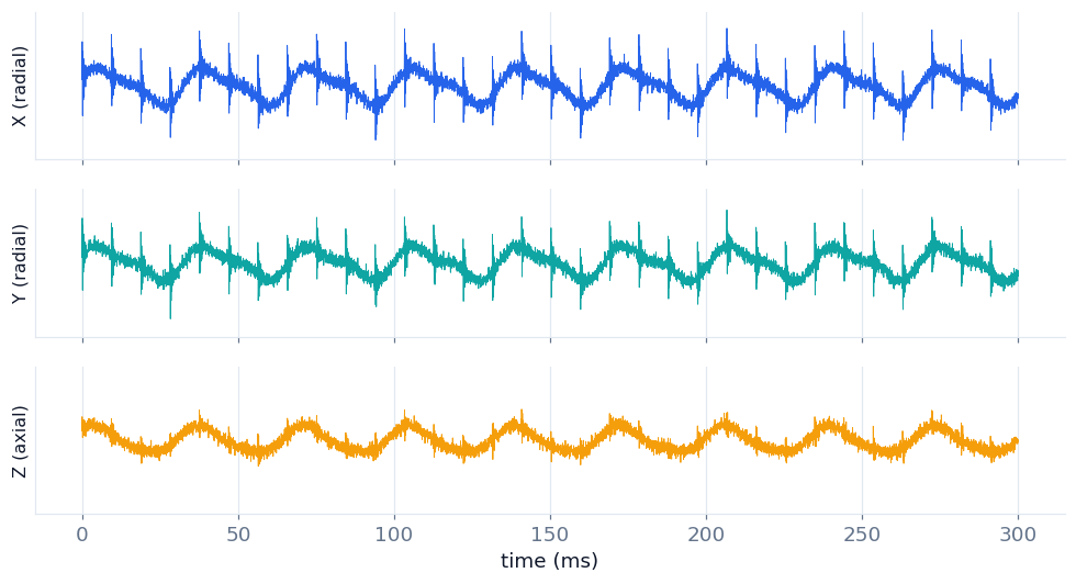 Triaxial acceleration signal on three axes showing periodic bearing impacts in the raw waveform